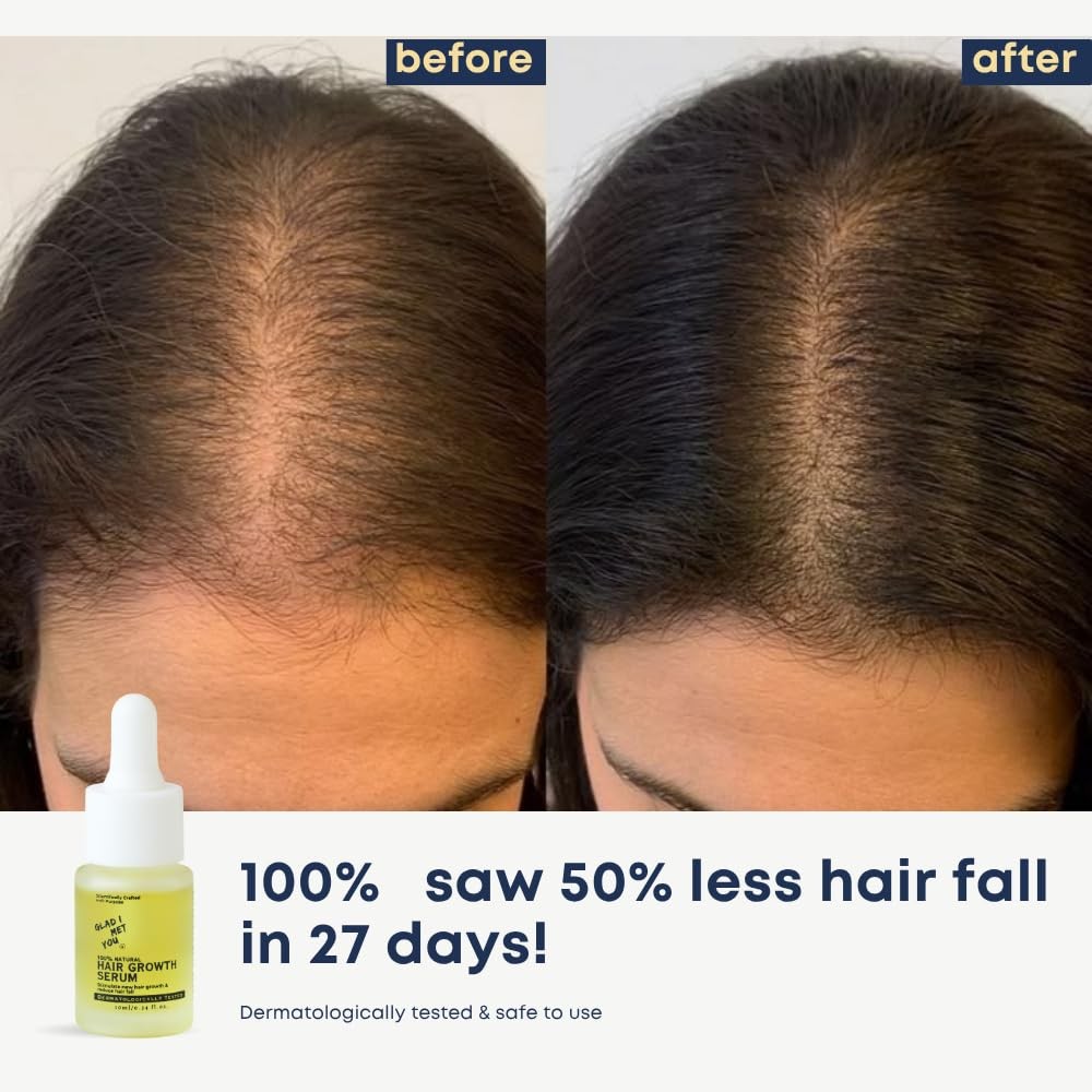 Hair Growth Serum with Rosemary & Castor Oils - Nourishing Natural Hair Treatment 10ml