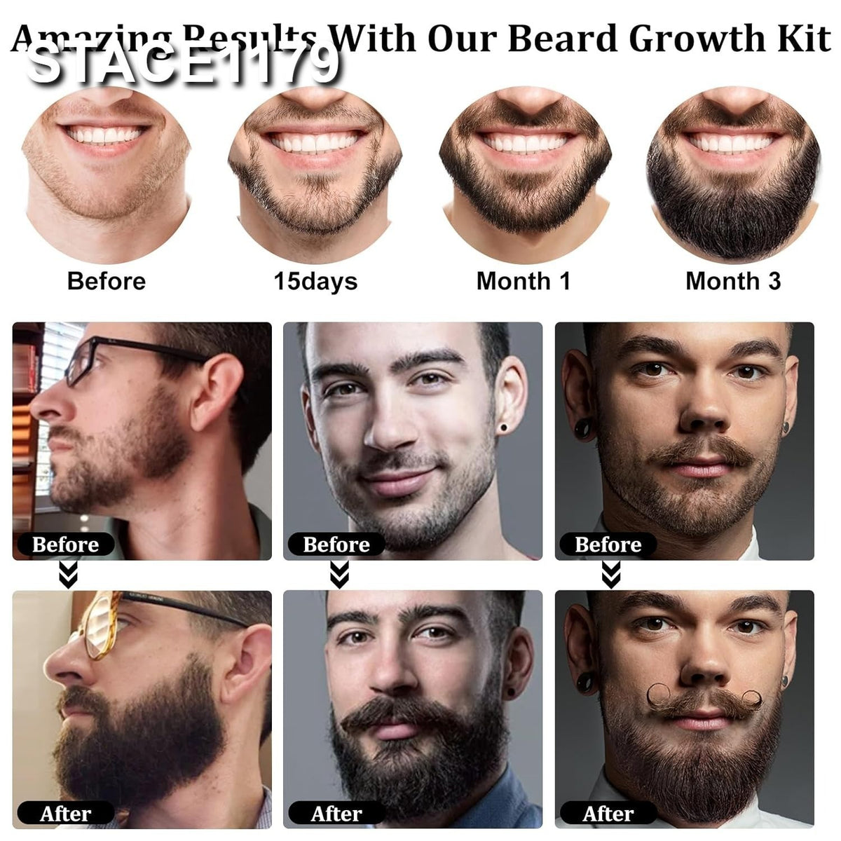 Premium Beard Growth Kit with Biotin Oil and Professional Massager
