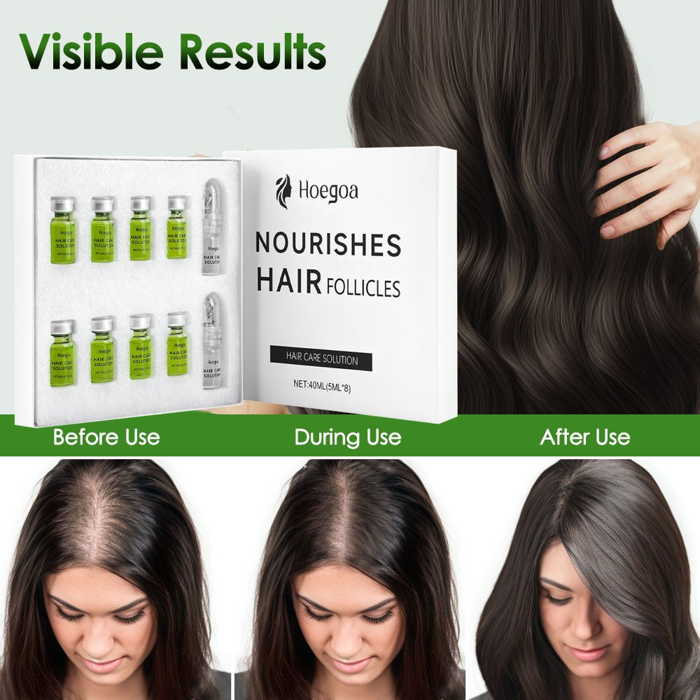 Infuse Hair Regrowth System with Ginseng & Natural Oils for Thicker Hair