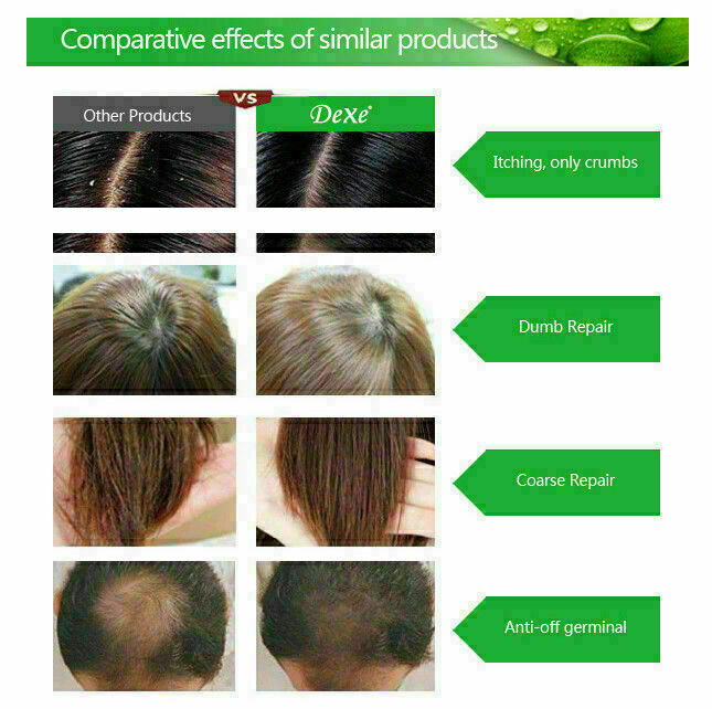 Anti-Hair Loss Shampoo with Ginger Tea Tree Oil for Hair Growth - 2 Pack