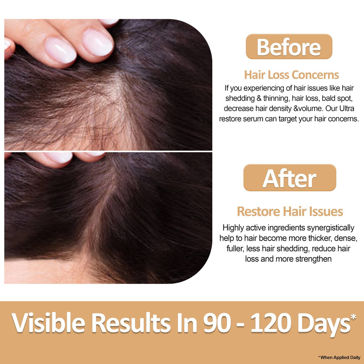 Hair Growth Serum for Thinning Hair & Hair Loss Reduction - 2N Ultra Restore