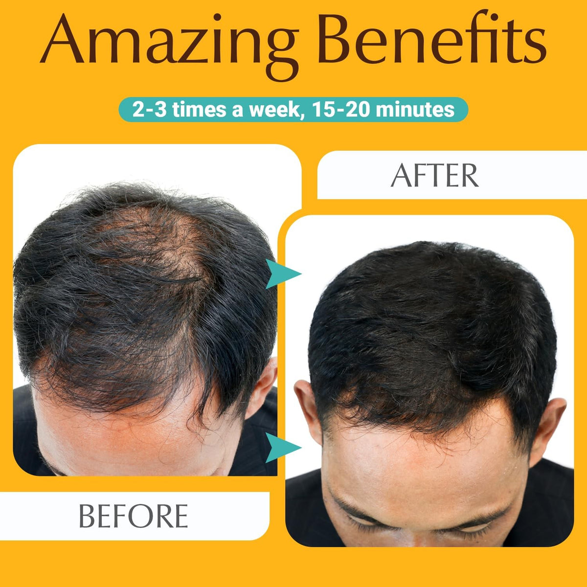 Hair Growth Comb for Men and Women - Portable & Easy to Use