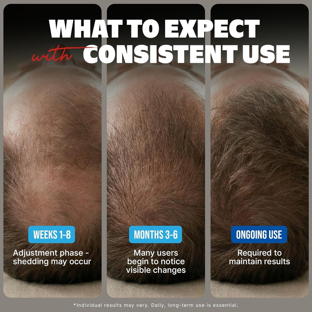 Hair Regrowth Treatment for Men - Minoxidil 5% Solution, 6 Month Supply