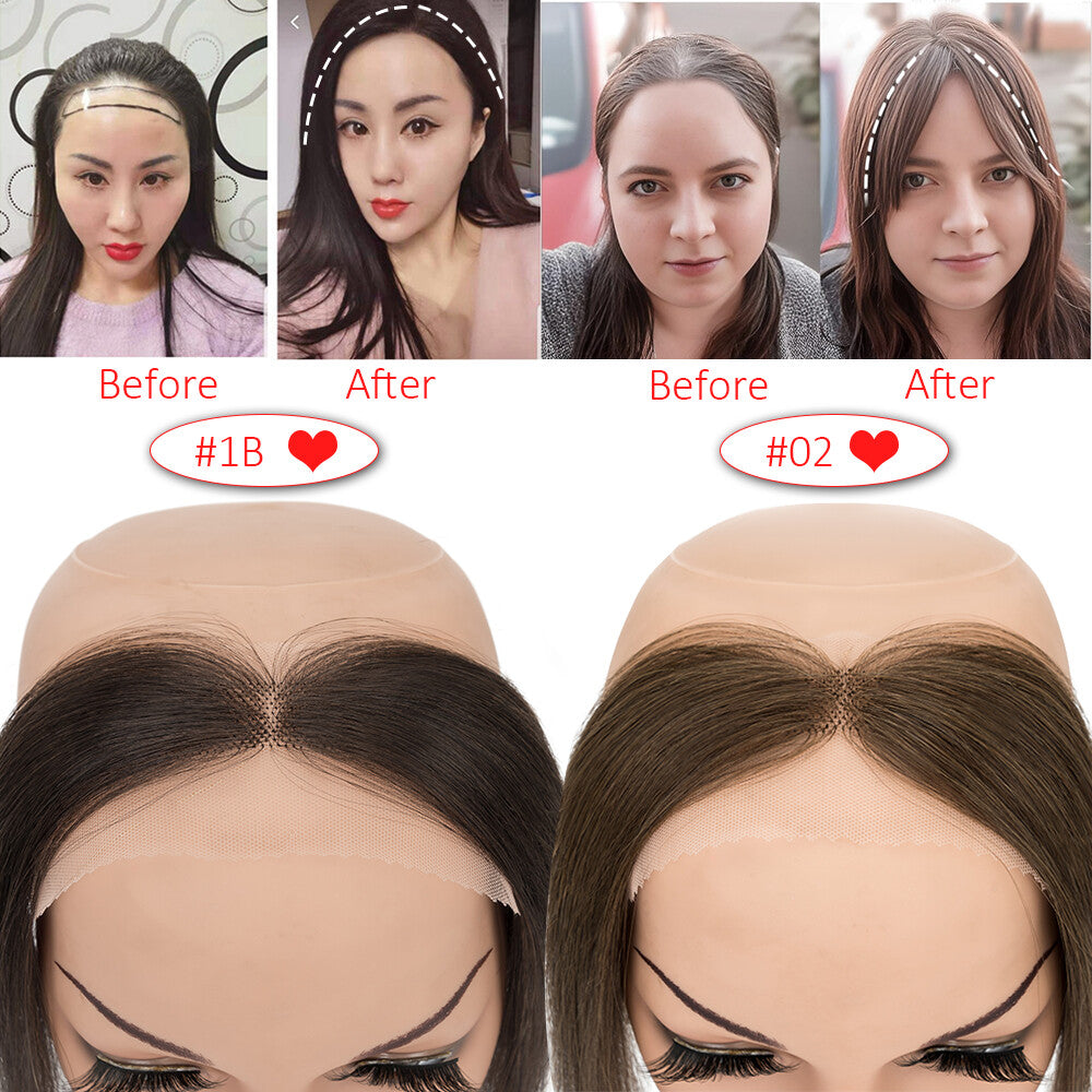 Full Lace Hair Topper for Women Receding Hairline Cover Remy Human Hair