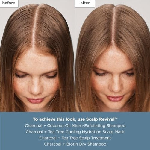 Scalp Treatment Serum with Charcoal and Tea Tree for Hair Care - Leave-In