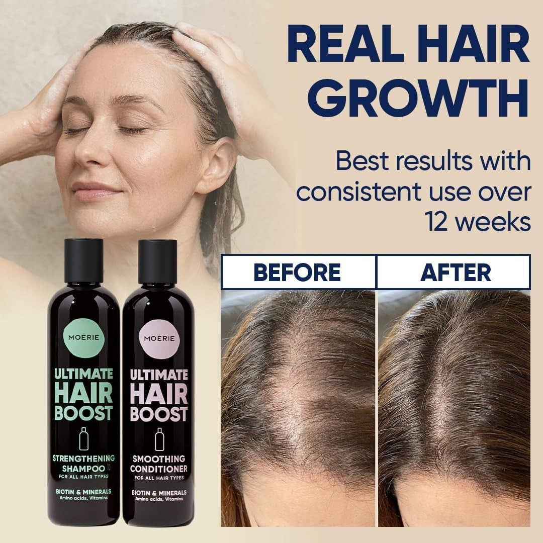 Hair Growth Shampoo & Conditioner Set for Men & Women - Biotin & Rosemary, Thicker Hair
