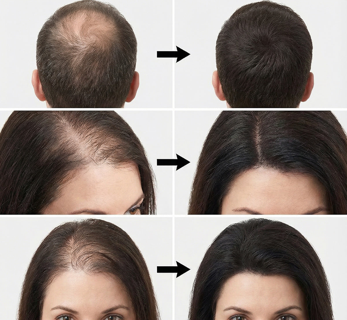 Hair Building Fibers for Thinning Hair | Instant Volume & Concealment