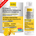 Salicylic Acid Psoriasis Shampoo - 6.76 Fl Oz, Scalp Relief & Moisturizing