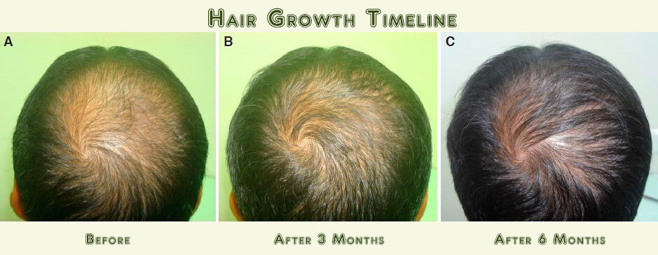 Hair Loss Regrowth Shampoo & Conditioner Set with 16 Natural Oils for Men Women