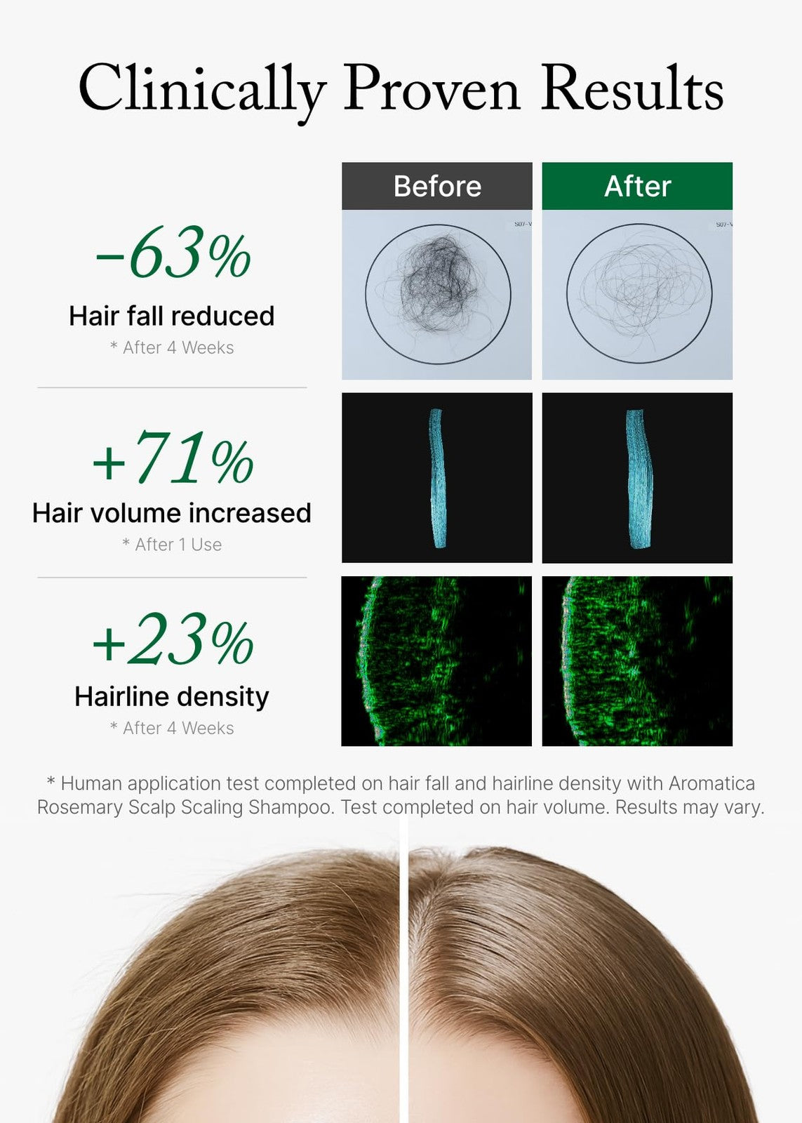 Rosemary Scalp Shampoo for Hair Growth & Thinning - Vegan & Sulfate Free 13.53oz