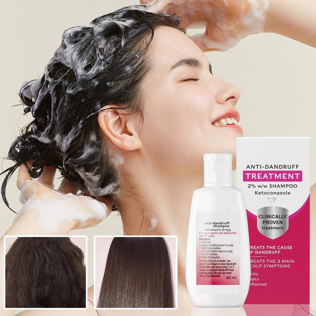 Anti-Dandruff Shampoo 2-Pack for Scalp Relief & Flake Control