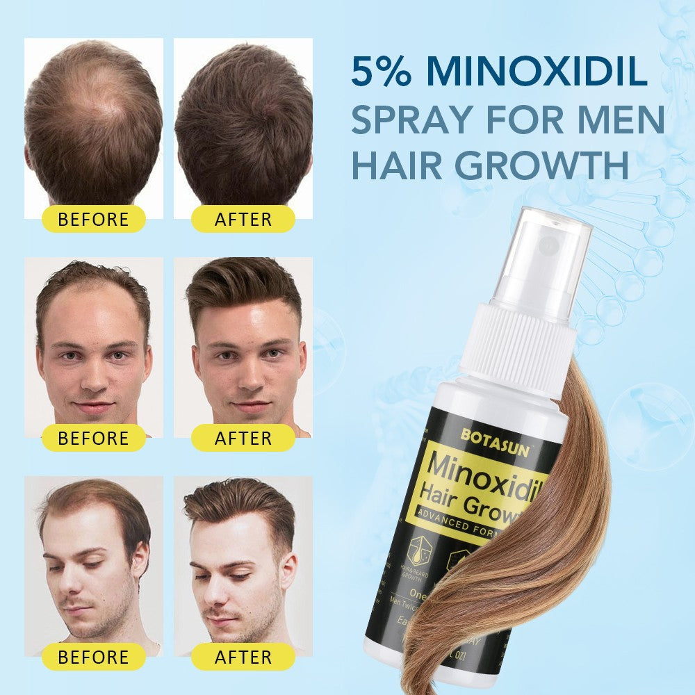 Minoxidil 5% Hair Regrowth Spray for Men - 60ml & Multiple Size Options
