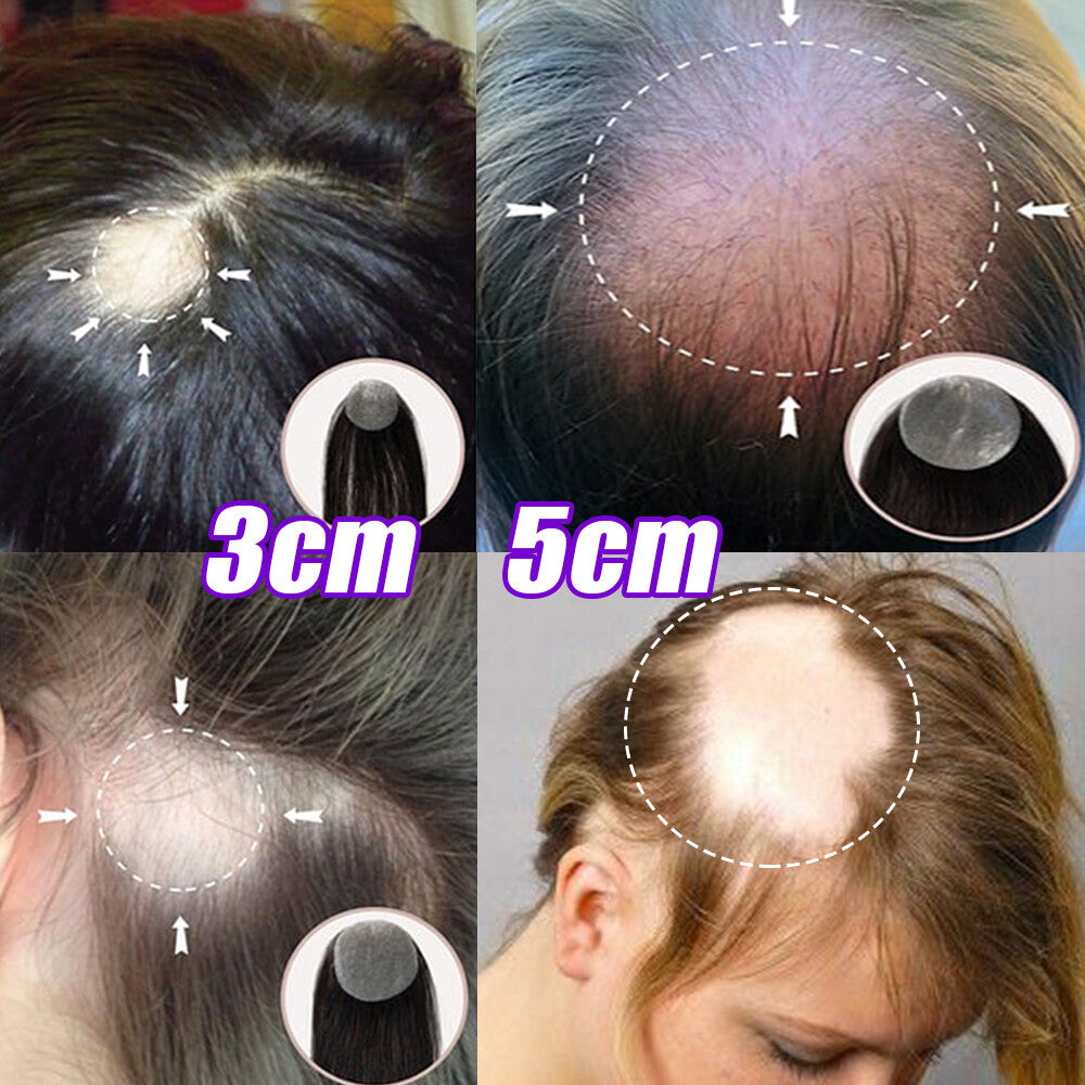 Full Lace Hair Cover-up Tape Patches for Hair Loss & Alopecia, Human Hair