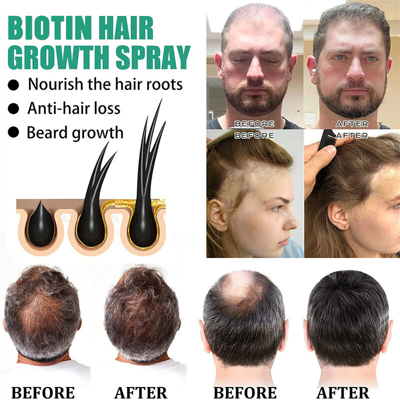 Biotin Hair Growth Serum & Spray for Thicker Hair - All Quantities